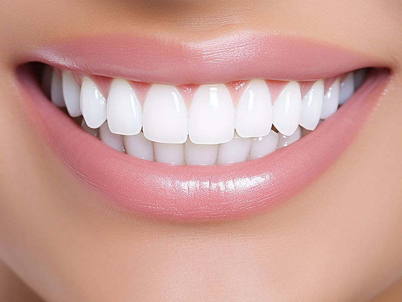 Hollywood Smile